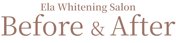Ela Whitening Salon Before & After